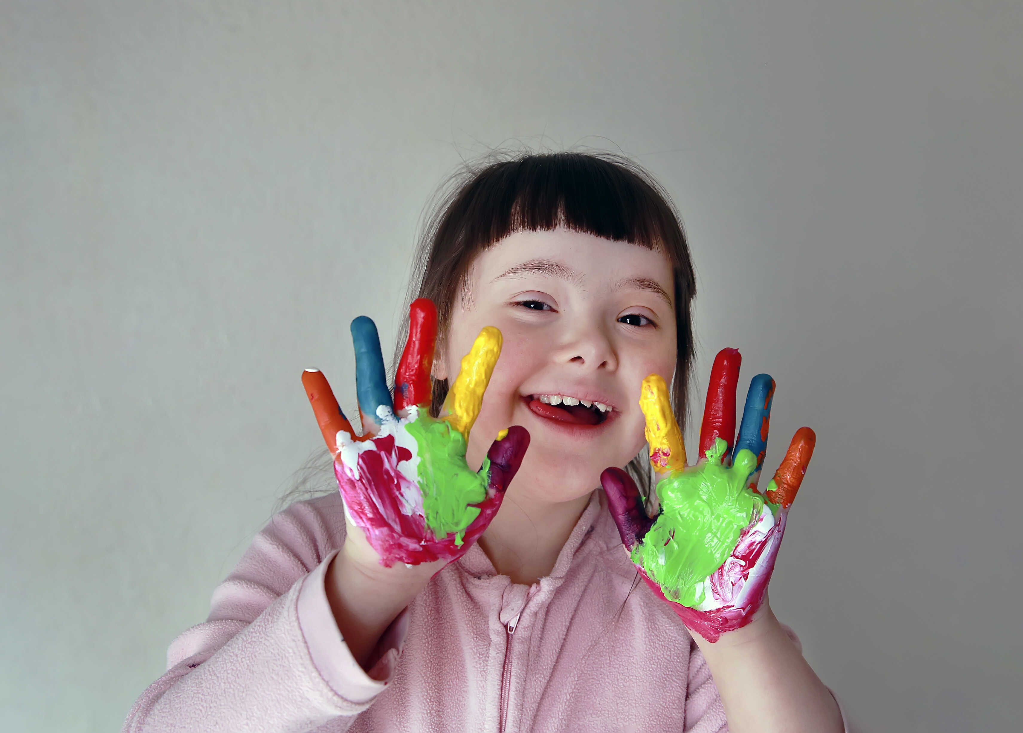 Ciri-ciri Anak Retardasi Mental yang Sering Dikira Autisme